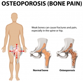 卡通骨质疏松性骨痛素材