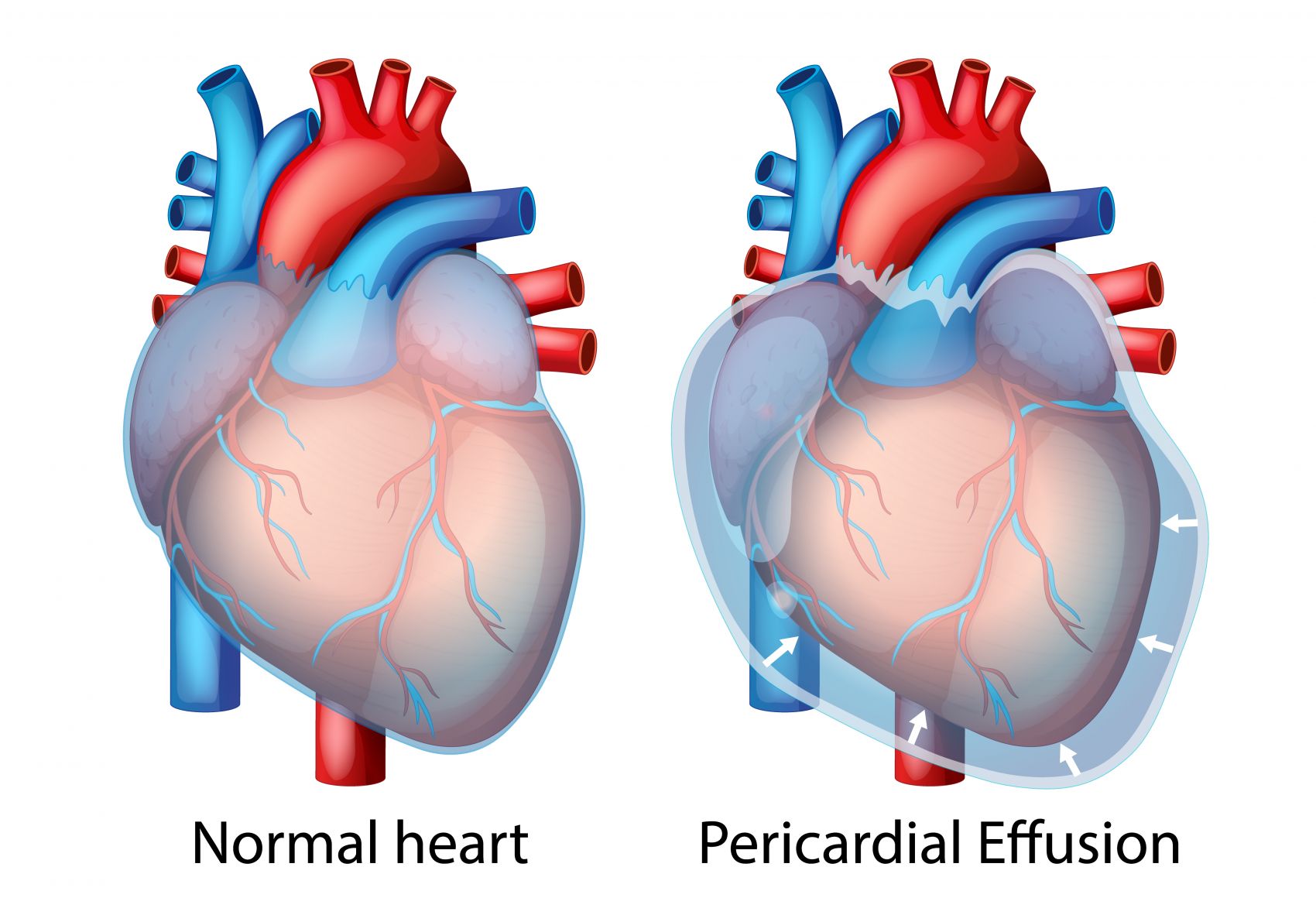 两款卡通人体心脏素材图片