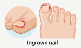 卡通嵌甲人脚的矢量插图